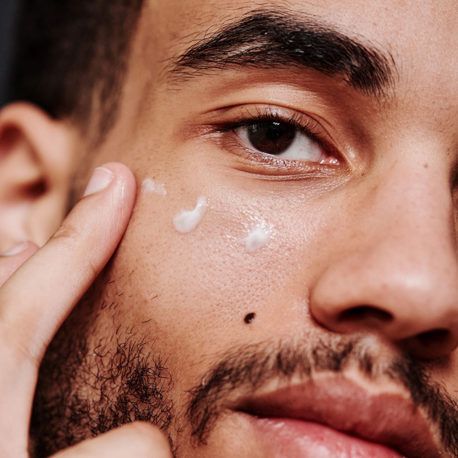 Spot Treatment Skincare for Men
